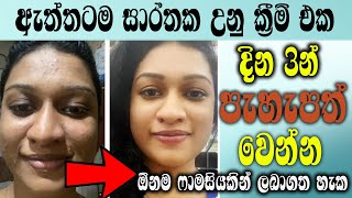 දවස් 3 න් ප්‍රතිපල. ඇත්තටම සුදුඋනා සම පැහැපත්උනා | Sudu wena cream | sudu wena krama Whitening cream