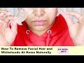 How To Remove Facial Hair And Whiteheads Naturaly at Home DIYWEEK DAY6 Shahnaz Shimul