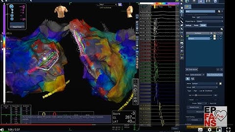High density and resolution mapping