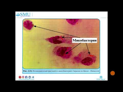 Бейне: Микобактериялардың грамдық реакциясы қандай?