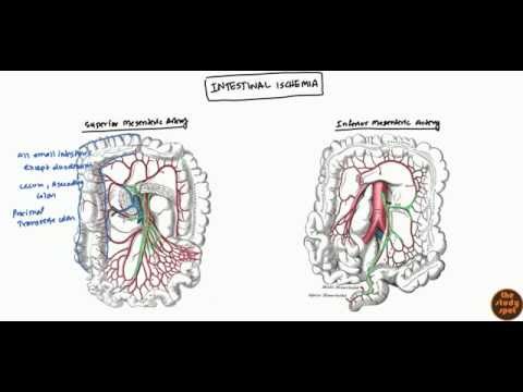 Mesenteric Ischemia, Ischemia Bowel and Colonic Ischemia for USMLE Step 2