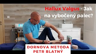 Hallux Valgus - Jak na vbočený palec?