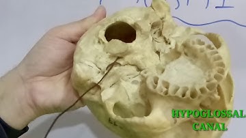 SKULL PART-1 FORAMINA AND STRUCTURES PASSING THROUGH THEM BY DR MITESH DAVE