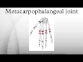 Metacarpophalangeal joint