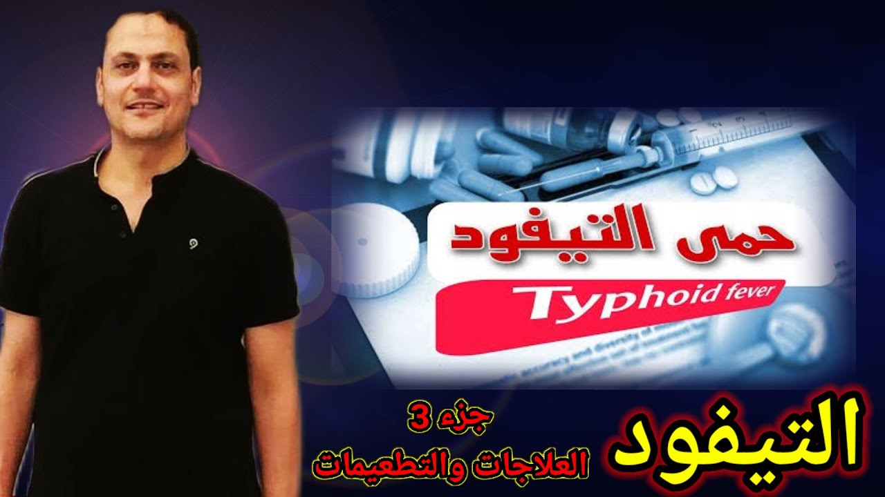 #حمي_التيفود