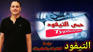 حمي_التيفود تيفود  typhoid fever جزء 3 العلاج والتطعيمات