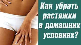 Как убрать растяжки в домашних условиях? Как убрать растяжки на теле?(Как убрать растяжки в домашних условиях? Как убрать растяжки на теле? Кликайте по ссылке http://hudeem99.ru/lp-yt Если..., 2015-07-07T12:21:36.000Z)