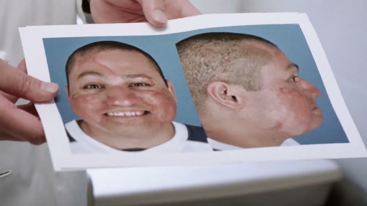 Operation Mend 15th Anniversary