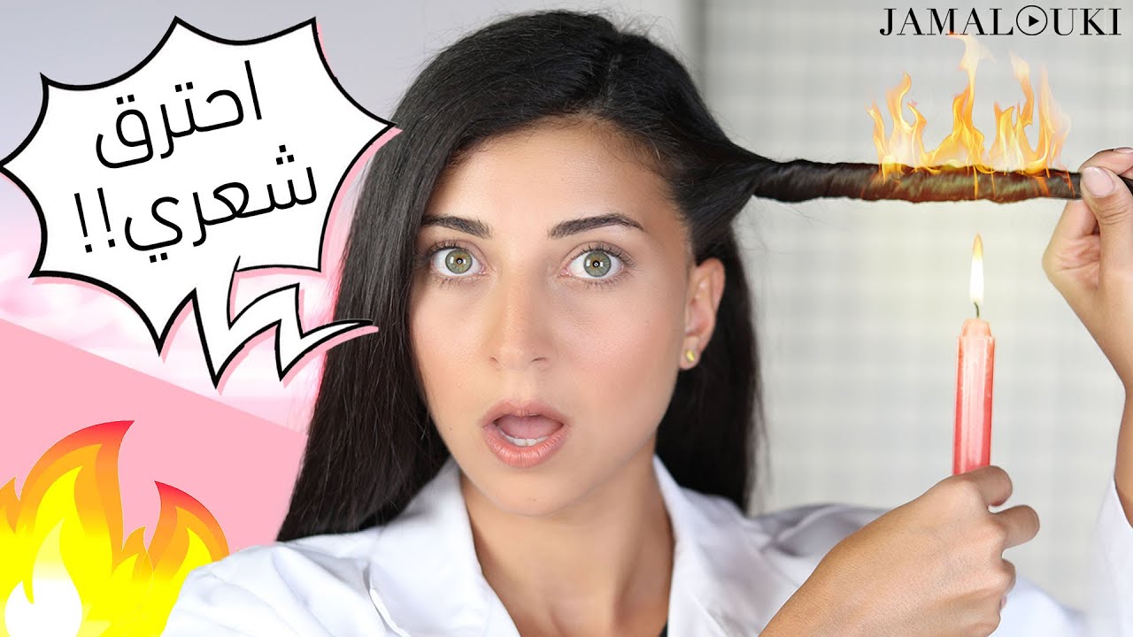 علاج تقصف الشعر: حرقتُ شعري لأتخلّص من تقصف الشعر