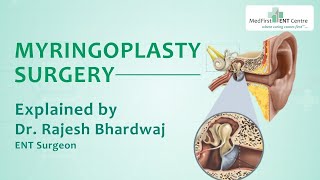 Myringoplasty DrRajeshBhardwaj | ENTSpecialist | ENTSurgeon