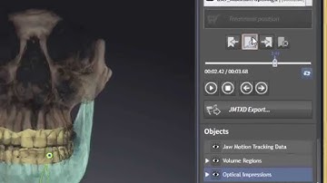 SICAT Function - Review Jaw Motion Tracking Data