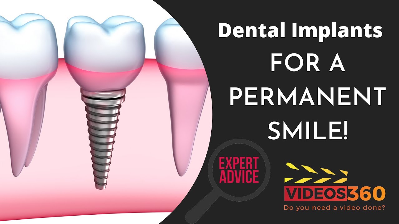 All about dental implants at Dentistry On 10 explained by Dr. Rina Kotecha