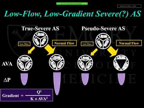 Emory Cardiology Grand Rounds 11-03-2014