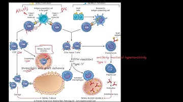 83P - Transplant rejection - Immunological basis and explanation, MHC, CD4+, CD8+, T cell