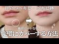 【30代女性必見】大人ニキビ・ニキビ跡を一撃で隠す!絶対バレないベースメイク術【保存版】