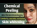 Chemical peeling malayalam||celebritys skin treatment||cosmetic treatment