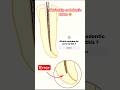 Don’t skip learning endodontic errors for your dental exams #dentalquiz #neet2026 #mfd #shorts