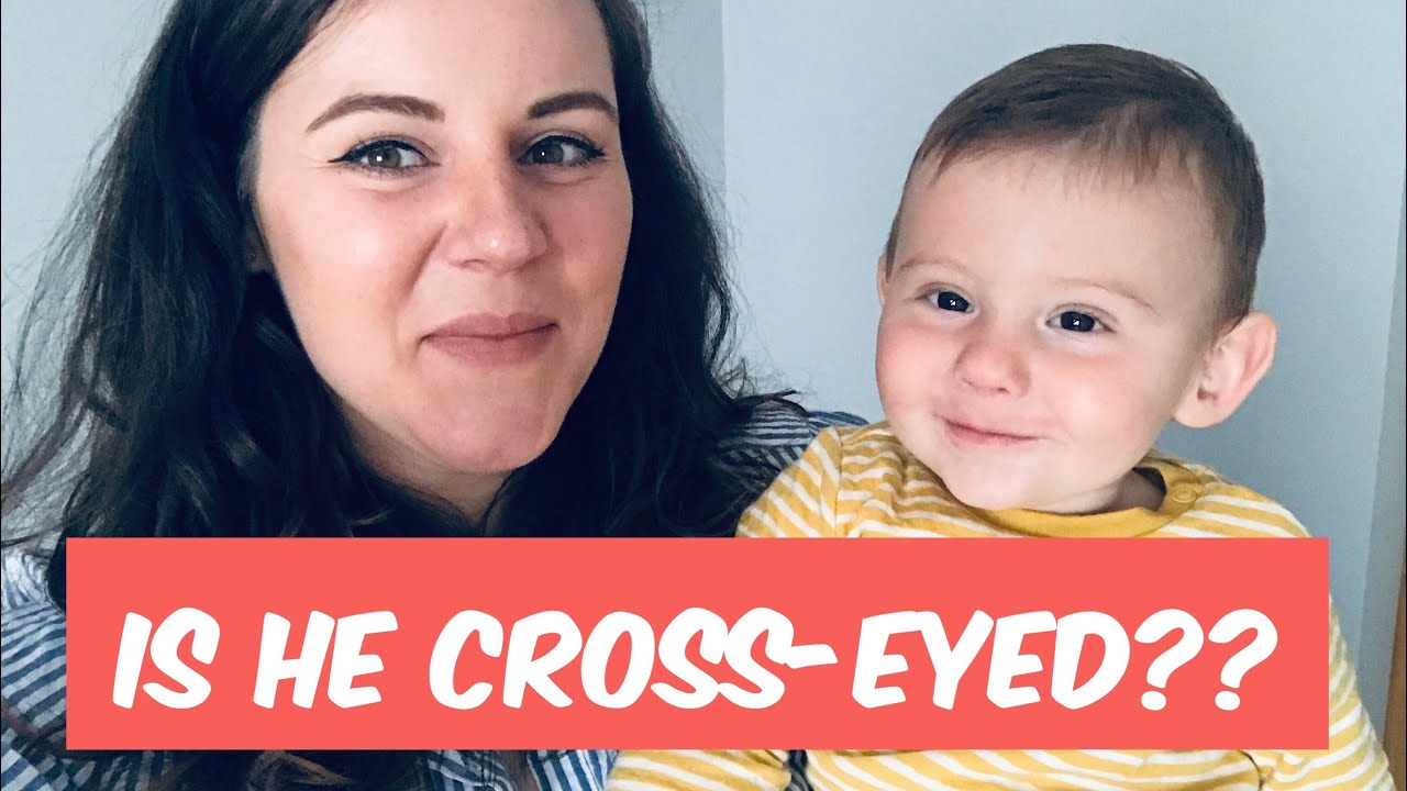 Is My Baby Cross Eyed? How To Check At Home YouTube