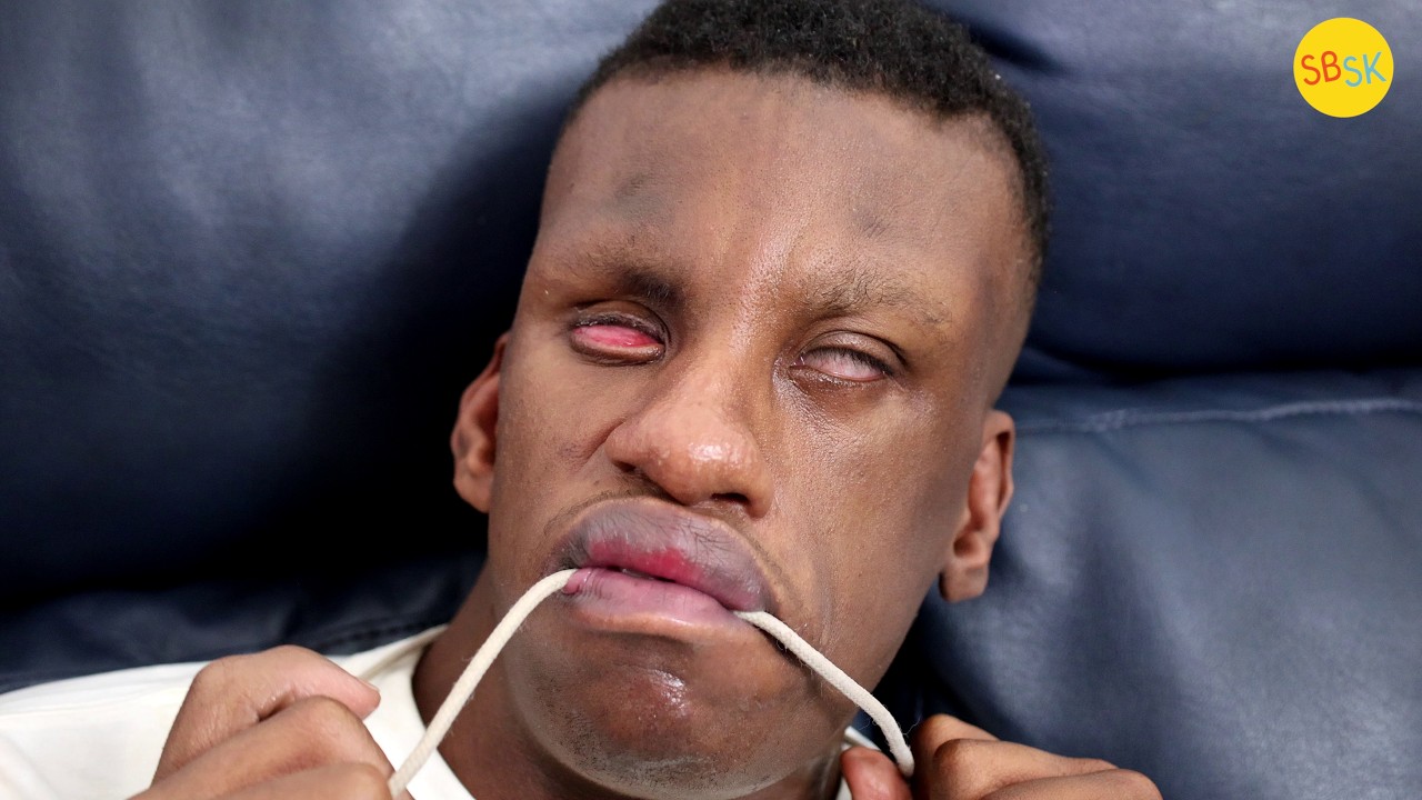 A DeafBlind Man Learning to Communicate (Max’s Story)