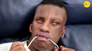 A DeafBlind Man Learning to Communicate (Max's Story)