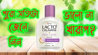 Lacto Calamine Oil Control Face Cream Review || এই ক্রিমটি সম্পর্কে পুরো সত্যিটা জানুন?