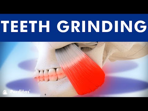 How to TREAT TMJ (Temporomandibular Joint) Dysfunction and BRUXISM (teeth grinding)  ©