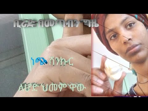 ቪዲዮ: ነጭ ጎመንን እንዴት እንደሚያድጉ