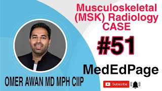 Musculoskeletal (MSK) Radiology CASE #51