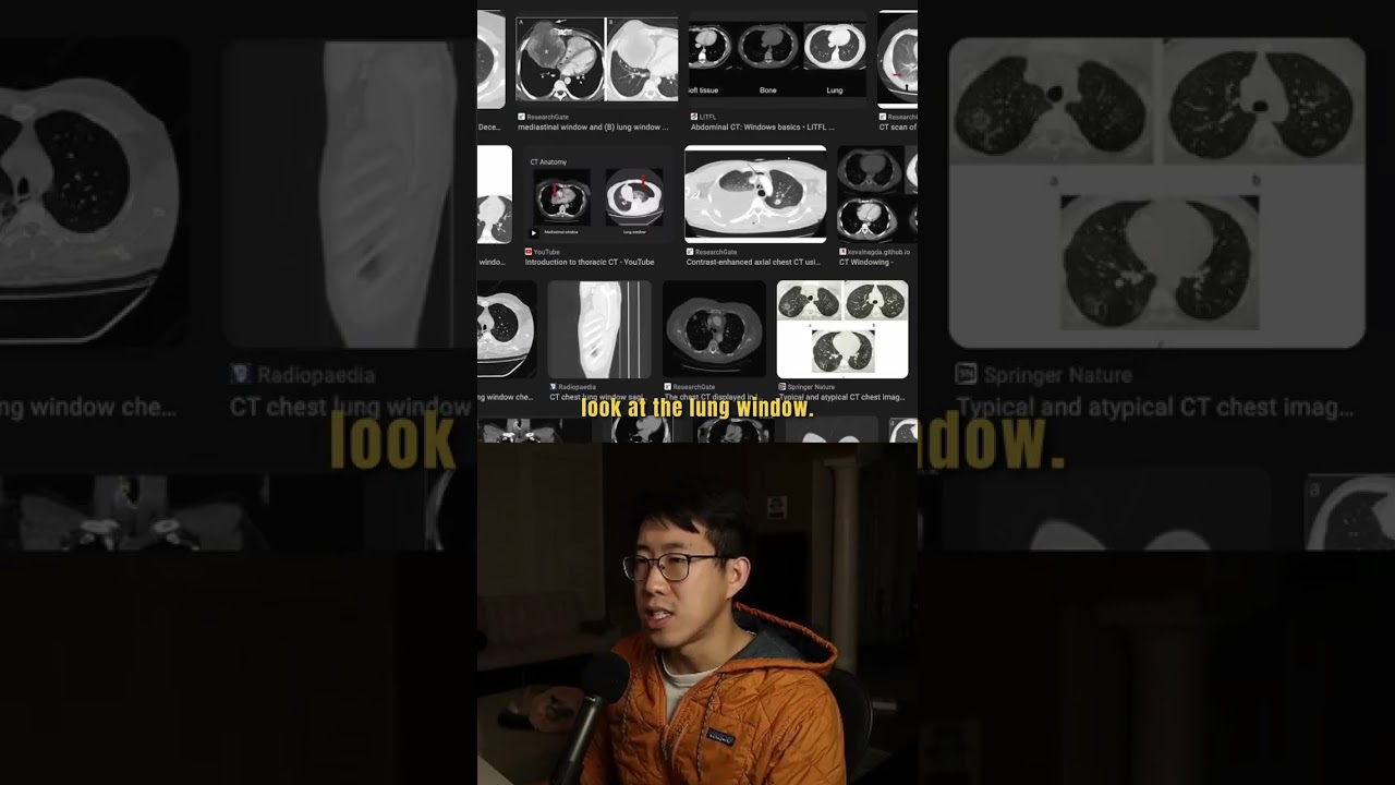What Bronchiectasis Looks Like In Your Lungs #medicine #meded #doctordle #medicaleducation