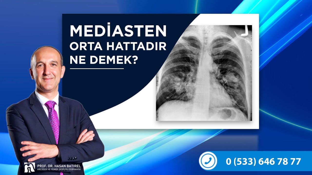 MED ASTEN ORTA HATTADIR NE DEMEK YouTube