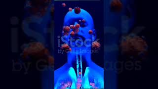 Pneumonia 3D Animation