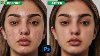 High - End Face Retouching - Best Photoshop Tutorial _ Skin retouching 2023 #photoshoptutorial