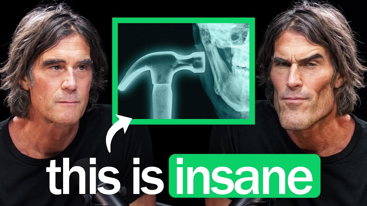 Inside The Dangerous World Of Looksmaxxing