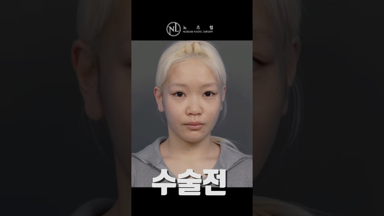 이사하라 사토미 코 모양, 왜 예쁘게 느껴질까?