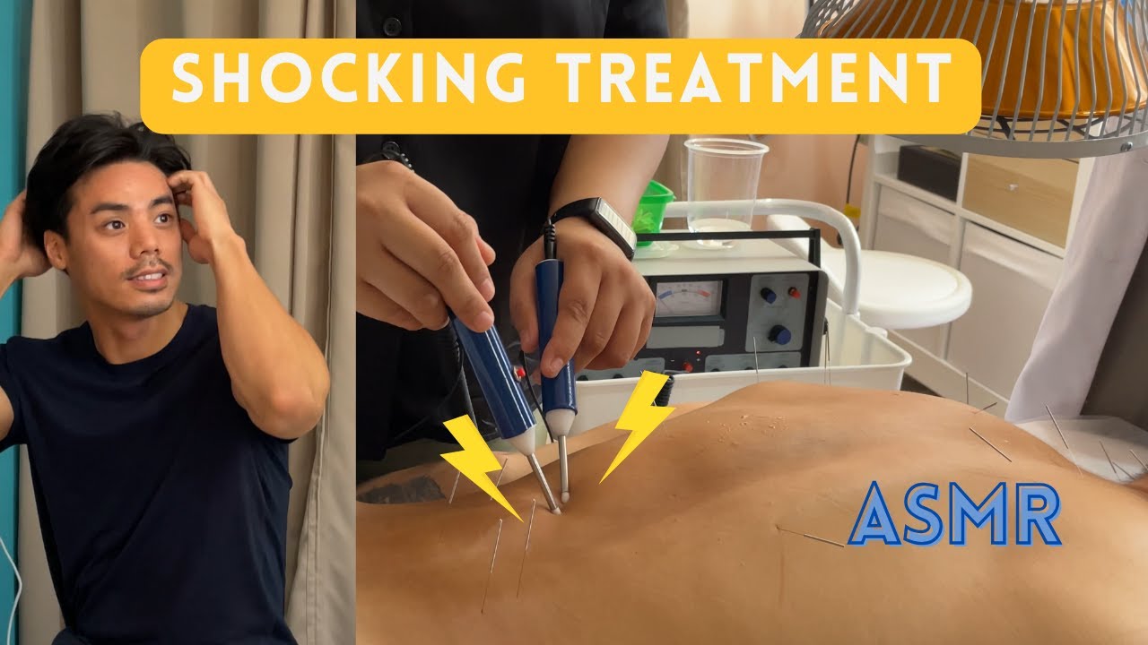 Relaxing Acupuncture and Fire Cupping to Release Chi Blockage ASMR