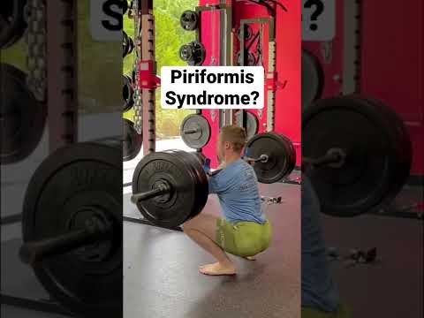 Video: Je plávanie dobré pri syndróme piriformis?