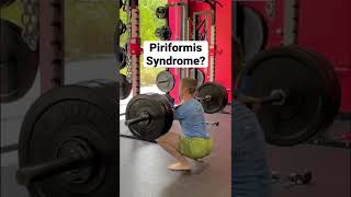 Piriformis Syndrome: HOW TO FIX!