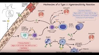 Type I Hypersensitivity - Mechanism (Described Concisely)