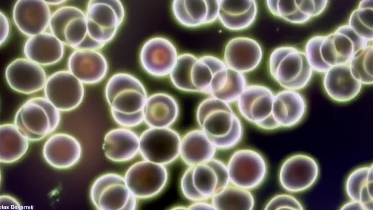 red-blood-cells-in-darkfield-microscopy-analysis-youtube