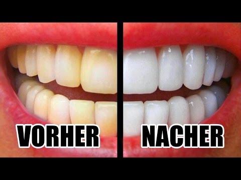 Video: Wie macht man Zähne weiß?