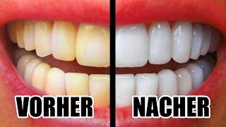 10 Einfache Tricks für weiße Zähne!