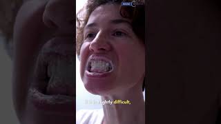 What is the correct brushing technique | Dental Creations