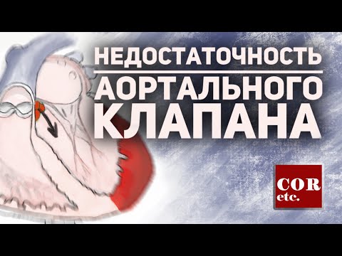 Video: Аорта регургитациясын кантип аныктоо керек: 14 кадам (сүрөттөр менен)