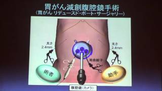 平成27年度愛知県がんセンター公開講座（第6回）【ロボット手術の展開について】（2）