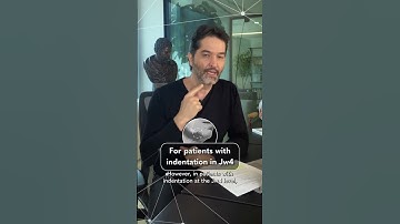 Q&A Session - Jw4 with Needles