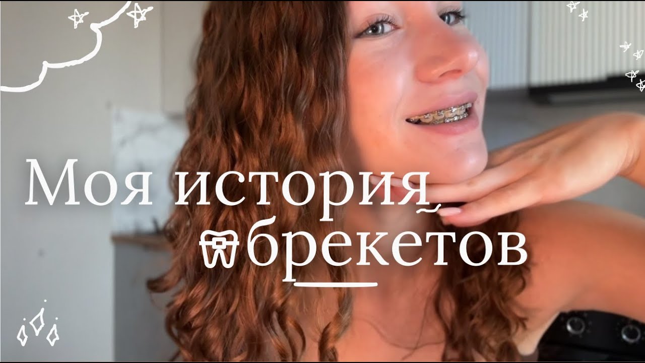 Я установила брекеты//Мой опыт