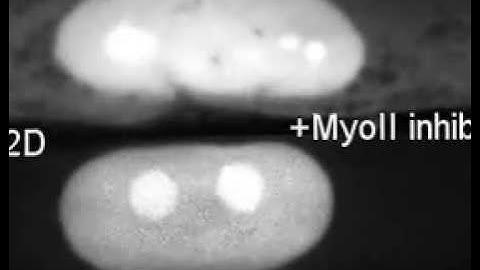 Cell Migration (Movie 2)