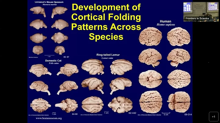 Mapping the Brain in Health, Aging, and Disease | ...