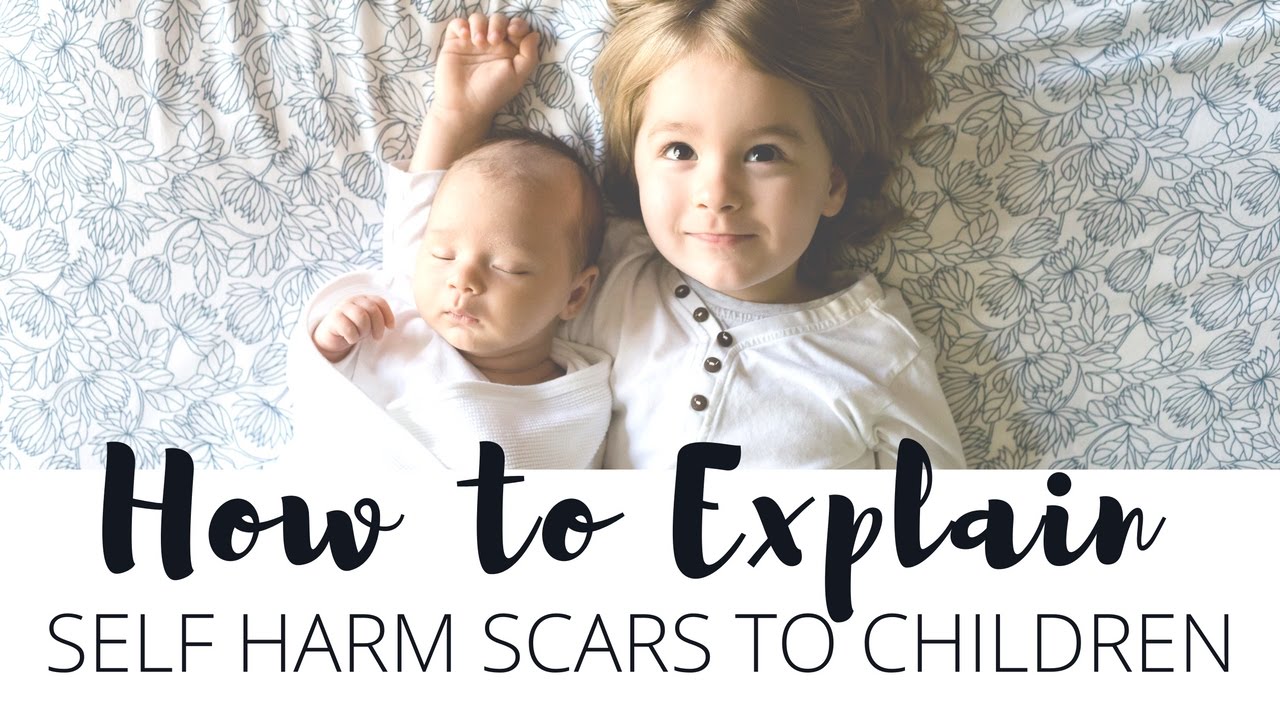 How To Explain Self Harm Scars To Children YouTube