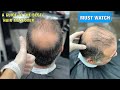 Hair Fibers Transformation | No Need Hair Transplant or Wig | JASON MAKKI Extra Hair Fibers
